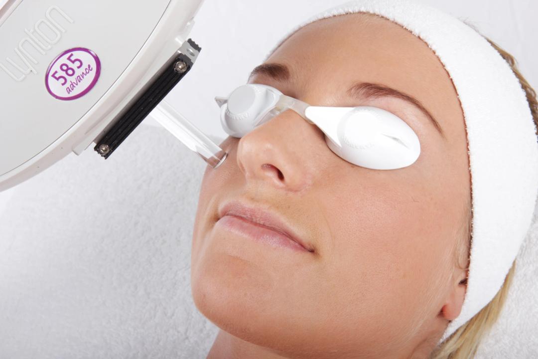 Client receiving skin rejuvenation treatment at Laser Care in Gravesend