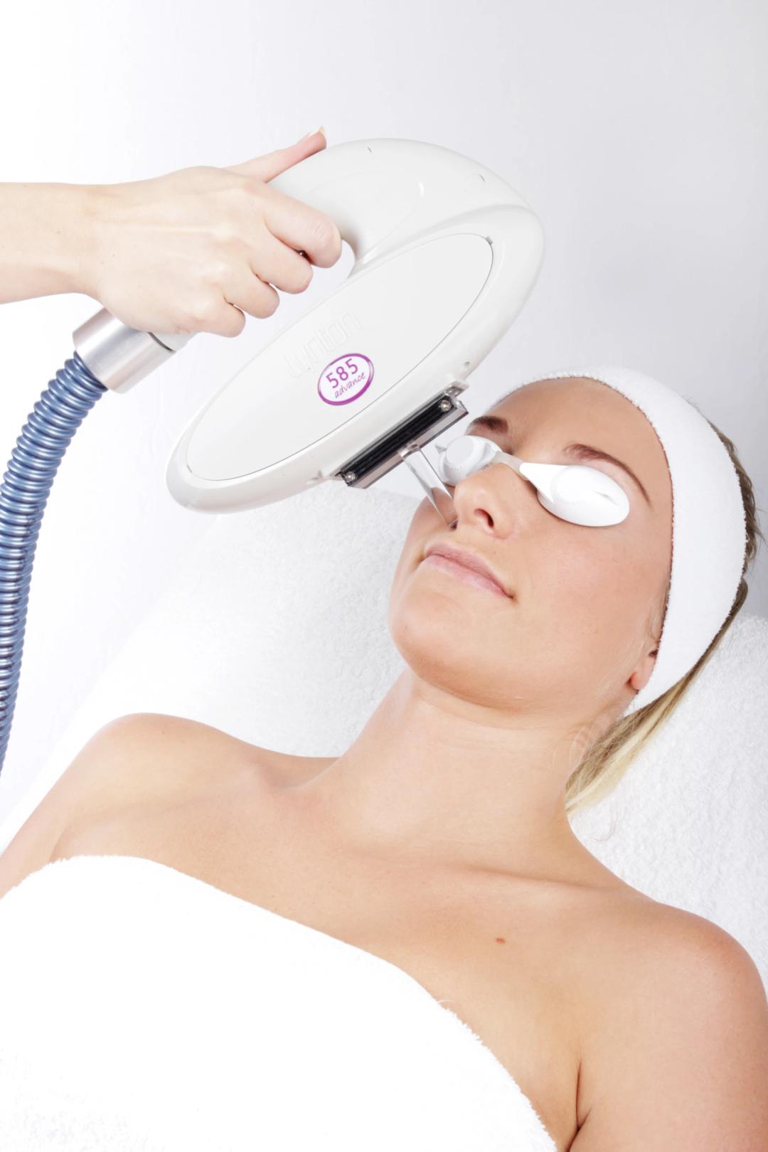 A client receives acne treatment at Laser Care, Gravesend